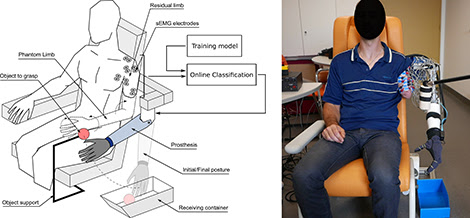 esperimento protesi controllata da arto fantasma